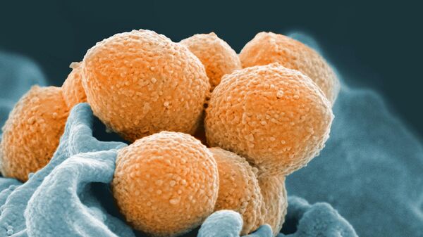 An electron microscope image of Group A Streptococcus - Sputnik International